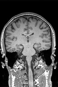 Teacher Jonathan Le Shana’s brain scan